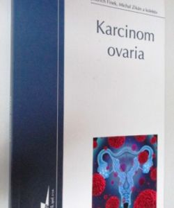 Karcinom Ovaria